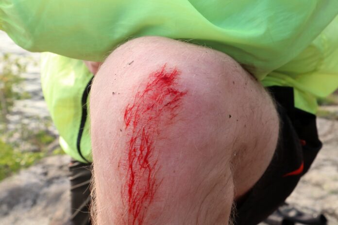 I don’t think that politicians will ever have any concern over how much they tax and spend. (Go to a school board meeting and see it firsthand.) Our system with its Base-Line Budgeting, Deficit Spending and FRAUD is specifically designed to keep the politicians' own skin FROM getting in the game.